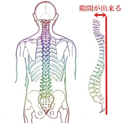 背骨の隙間